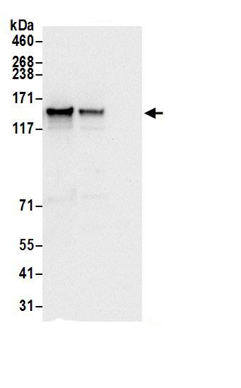 DIAPH3 Antibody