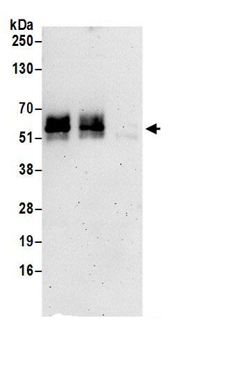 KCNK5 Antibody