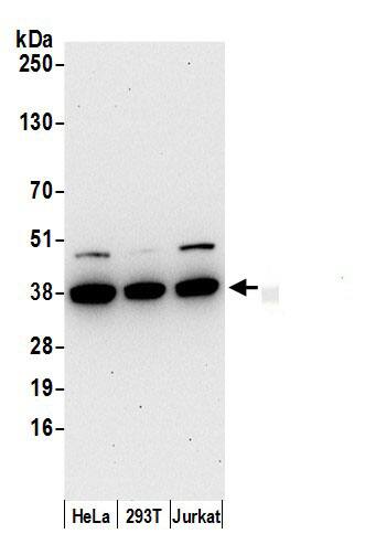 AKR1B1 Antibody