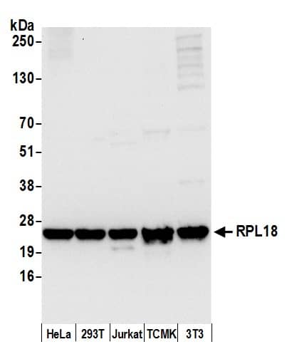 RPL18 Antibody