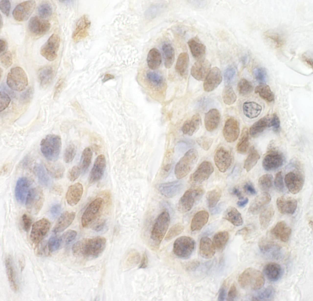 CDK8 Antibody