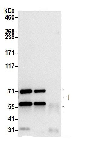 Prolyl Oligopeptidase/PREP Antibody