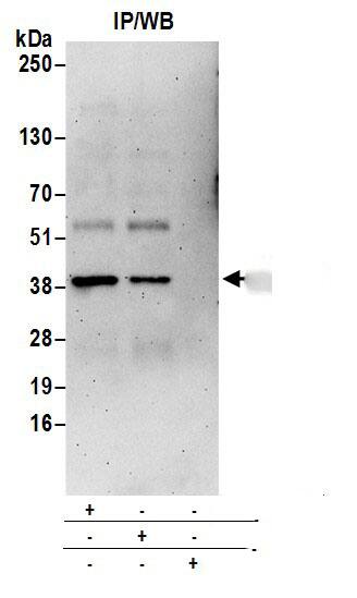 Biliverdin Reductase A/BLVRA Antibody
