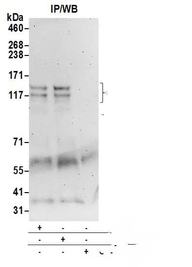 CDAN1 Antibody