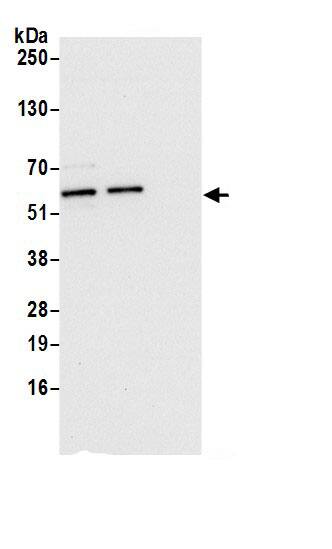 Fascin Antibody