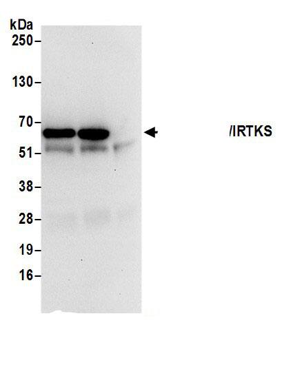 BAIAP2L1 Antibody