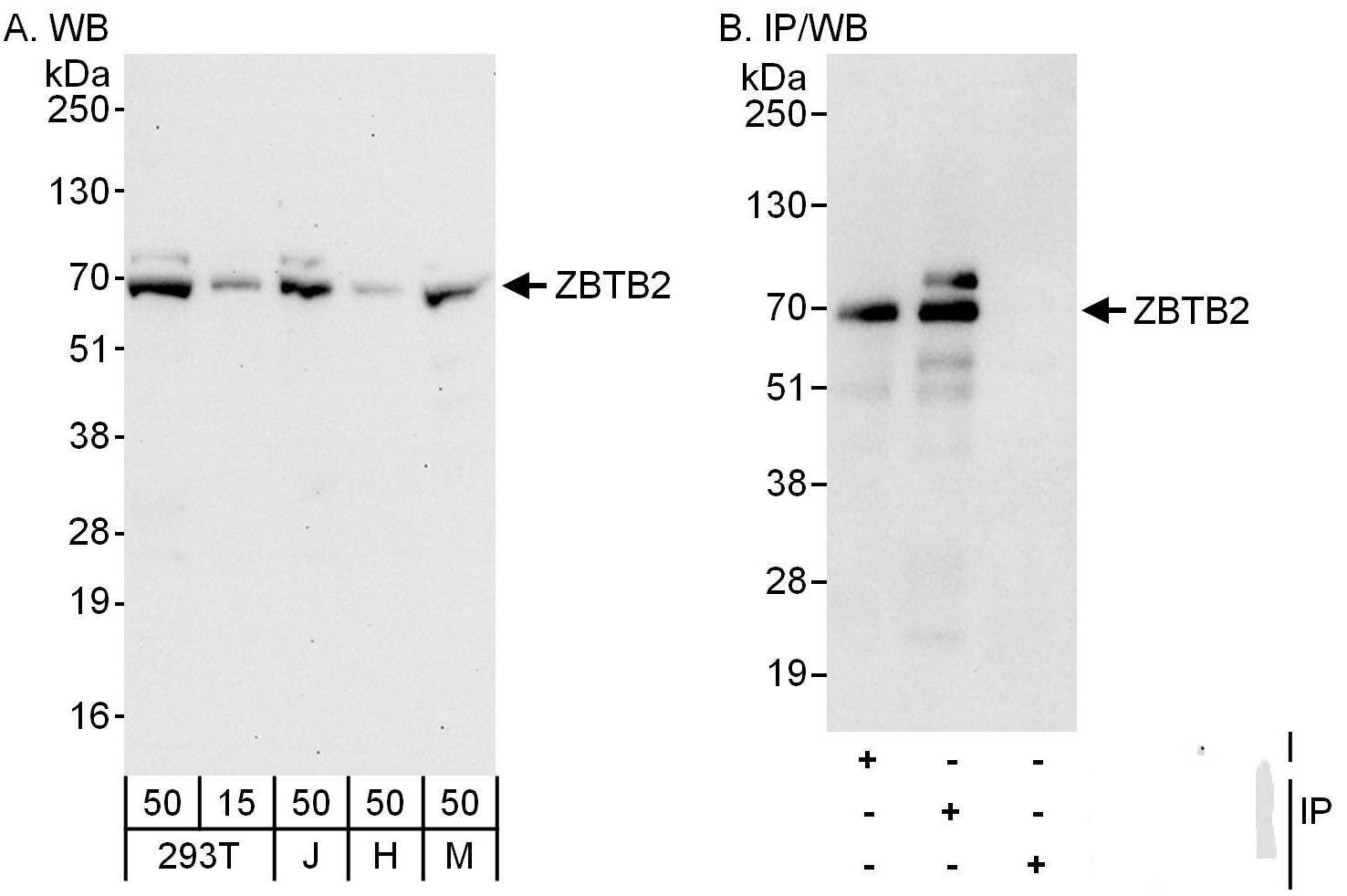 ZBTB2 Antibody