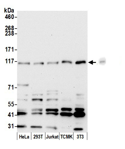 ANKFY1 Antibody