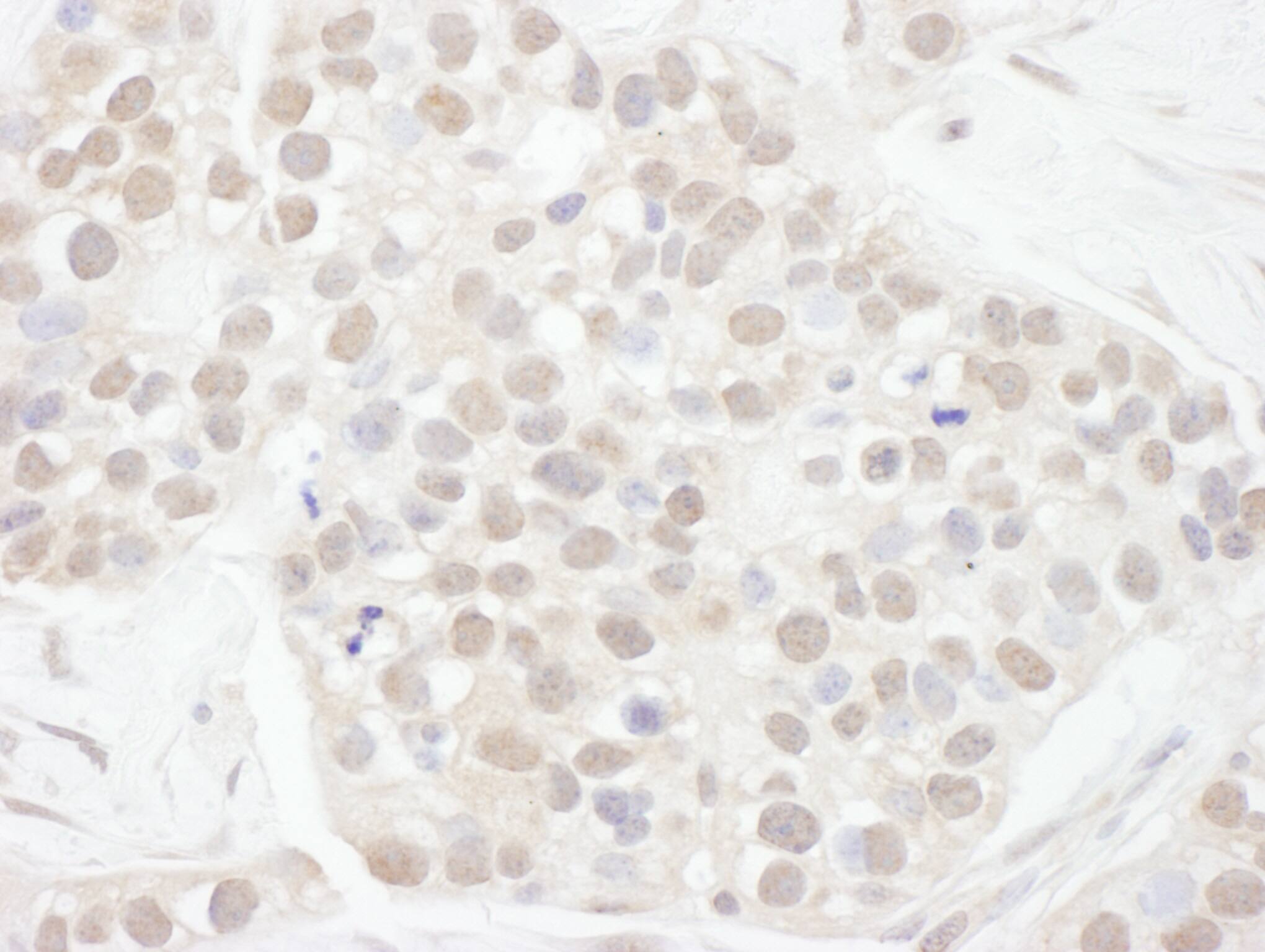 Cyclin T1 Antibody