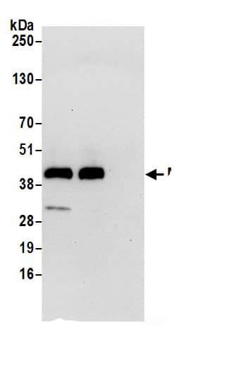 Mannose Phosphate Isomerase Antibody