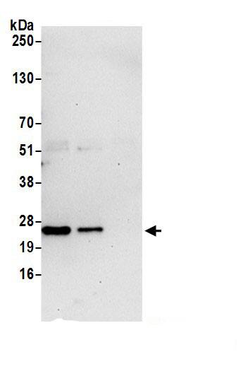 DTYMK Antibody