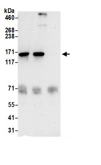 TBC1D9B Antibody