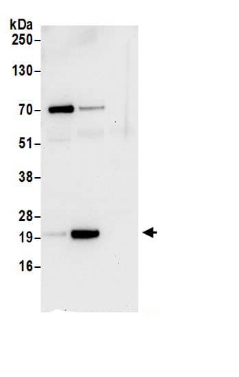 NDUFS8 Antibody