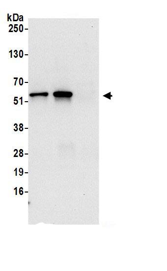 OXCT1 Antibody