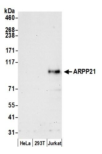 ARPP-21 Antibody