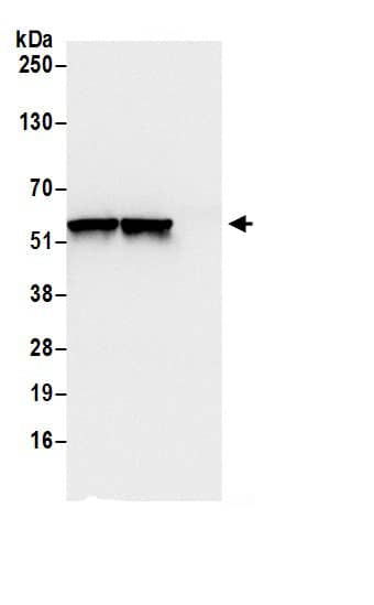 Dihydrolipoamide Dehydrogenase/DLD Antibody