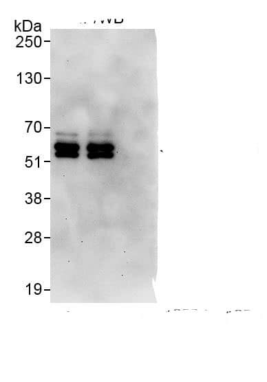 PPP2R5C Antibody
