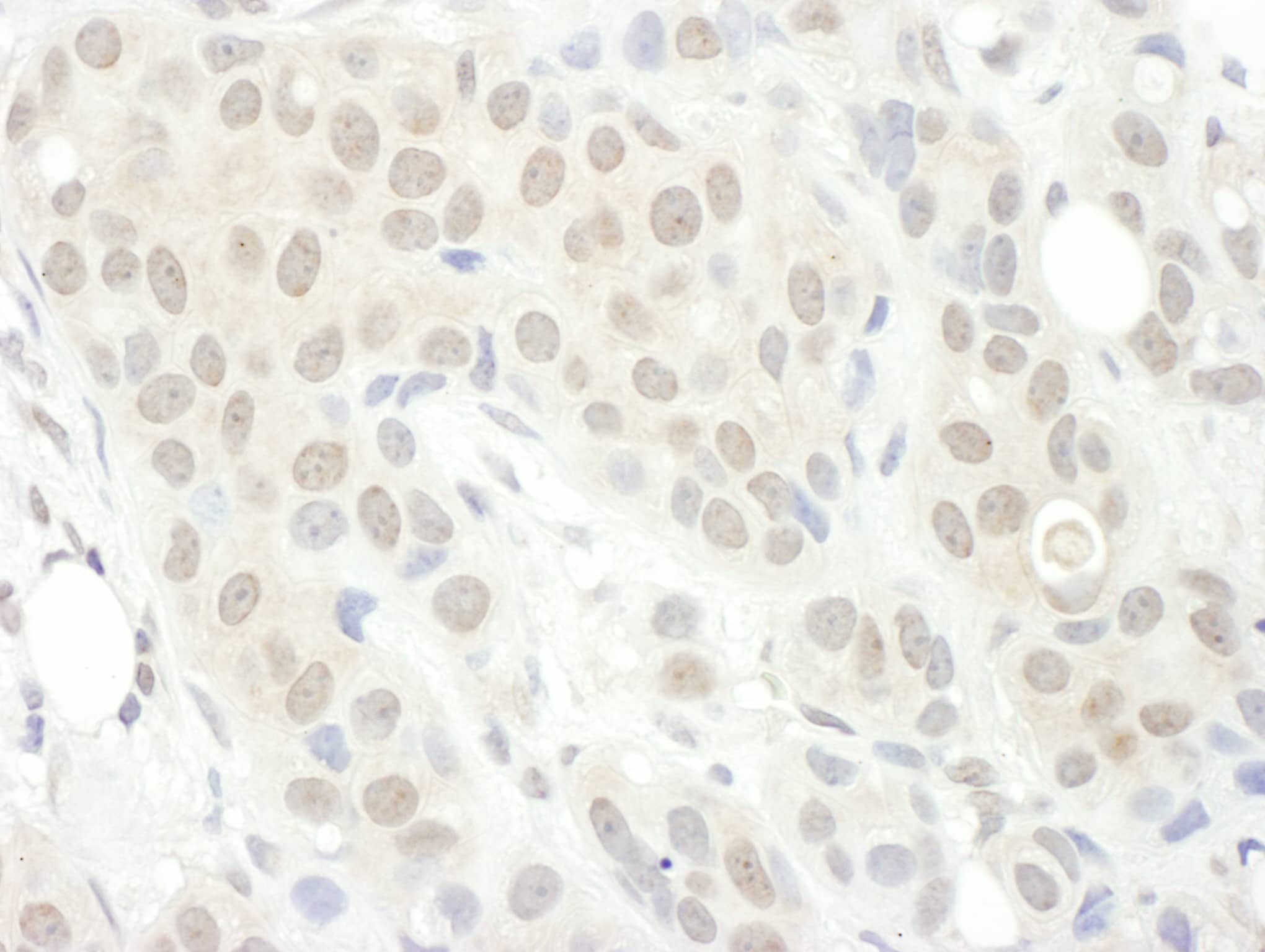 PPP2R5C Antibody