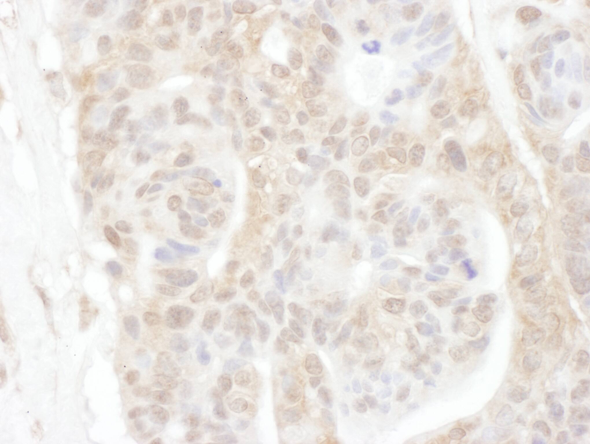 RBX1 Antibody