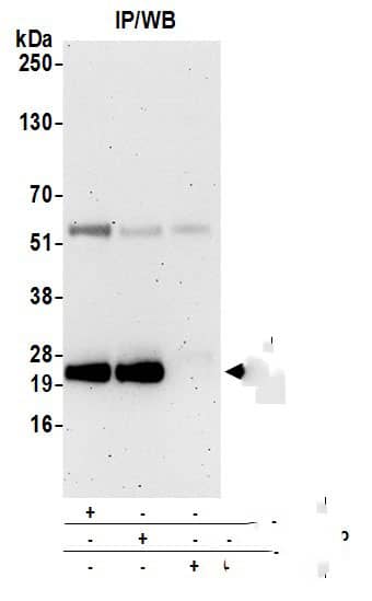 CD3 delta Antibody