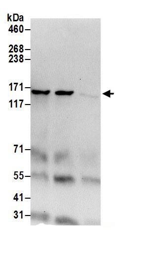 Isoleucyl tRNA synthetase Antibody