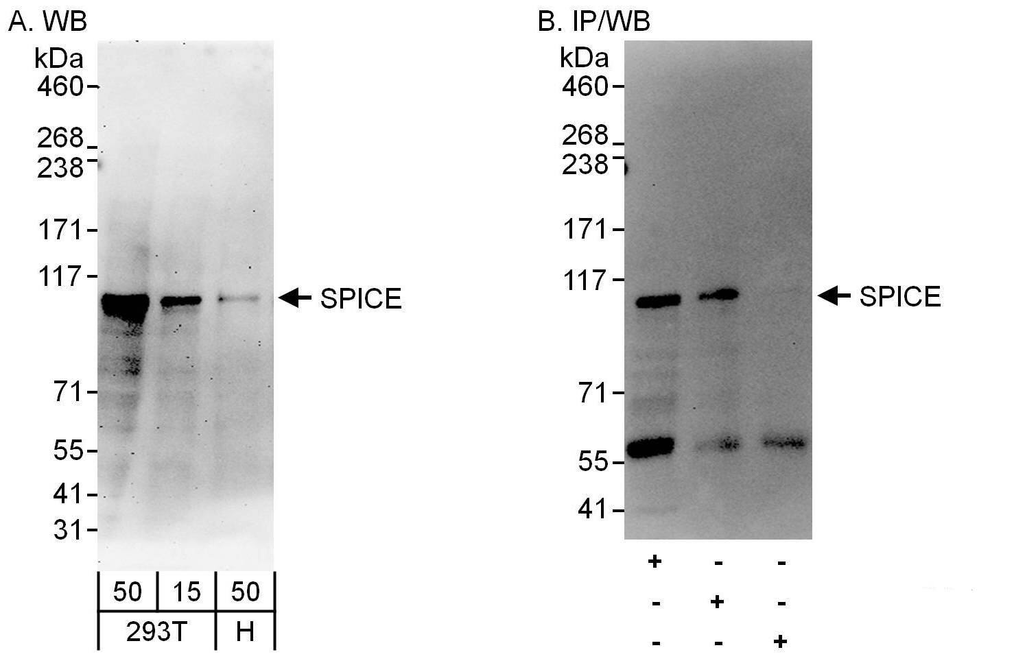 SPICE1 Antibody