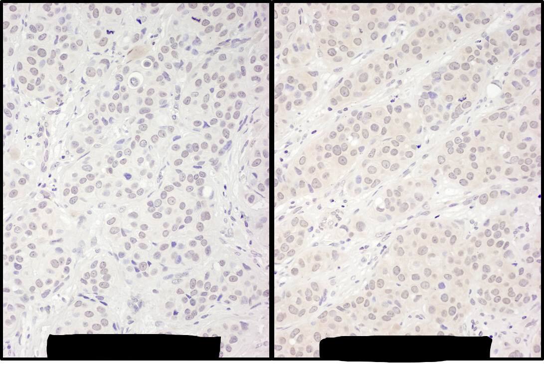 DDX56 Antibody