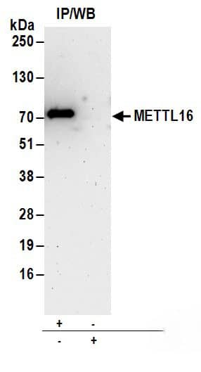 METT10D Antibody