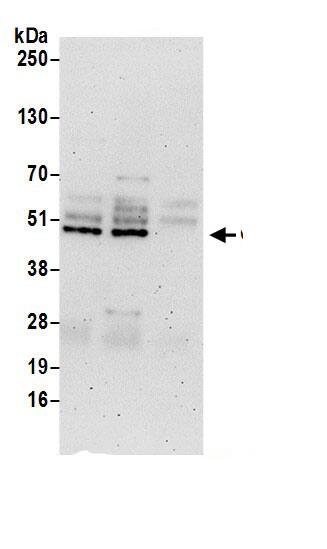 CD2BP2 Antibody