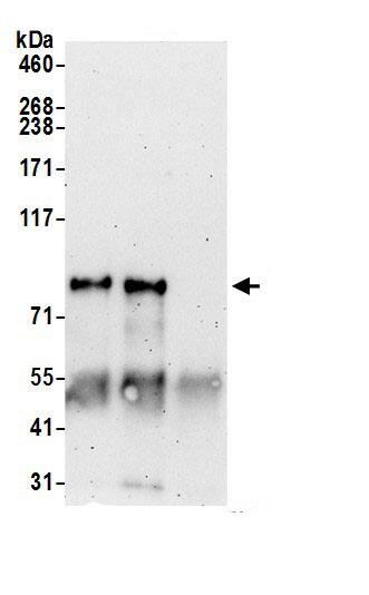 ATXN1L Antibody