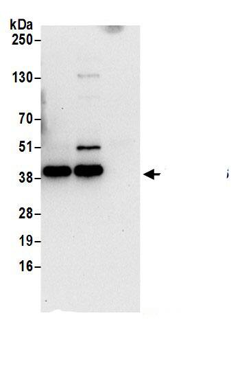 Serpin B6 Antibody