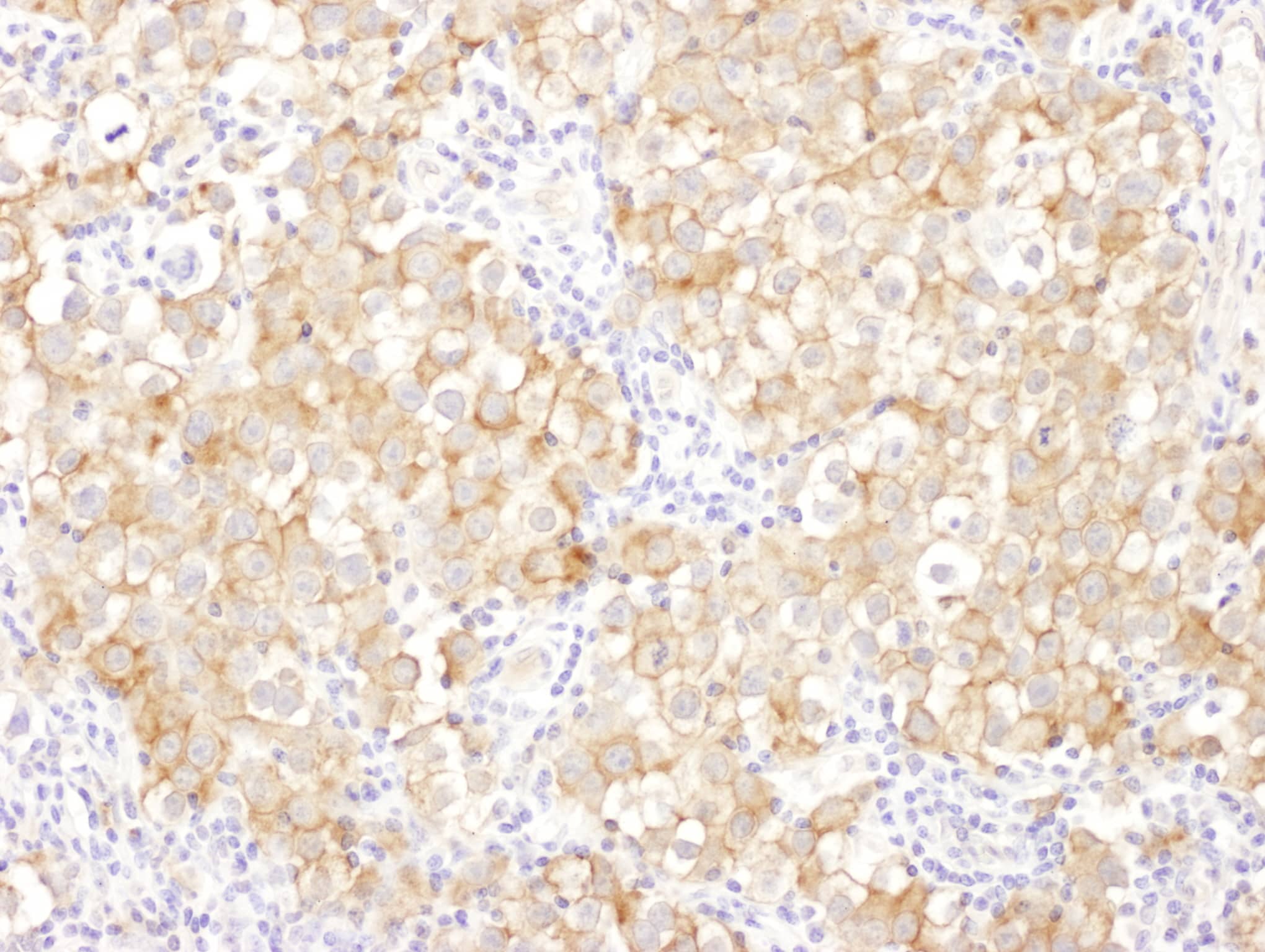 Drebrin 1 Antibody