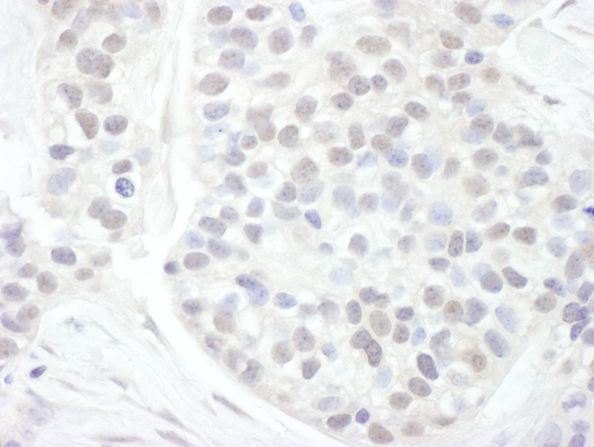 Cyclin T1 Antibody