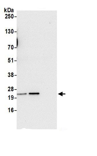 Synaptobrevin homolog YKT6 Antibody