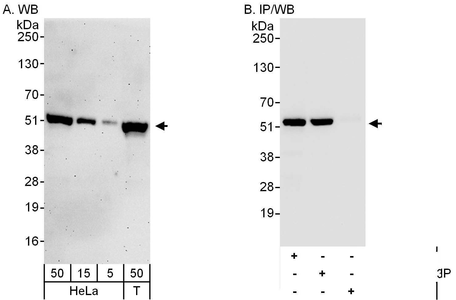 DDX47 Antibody