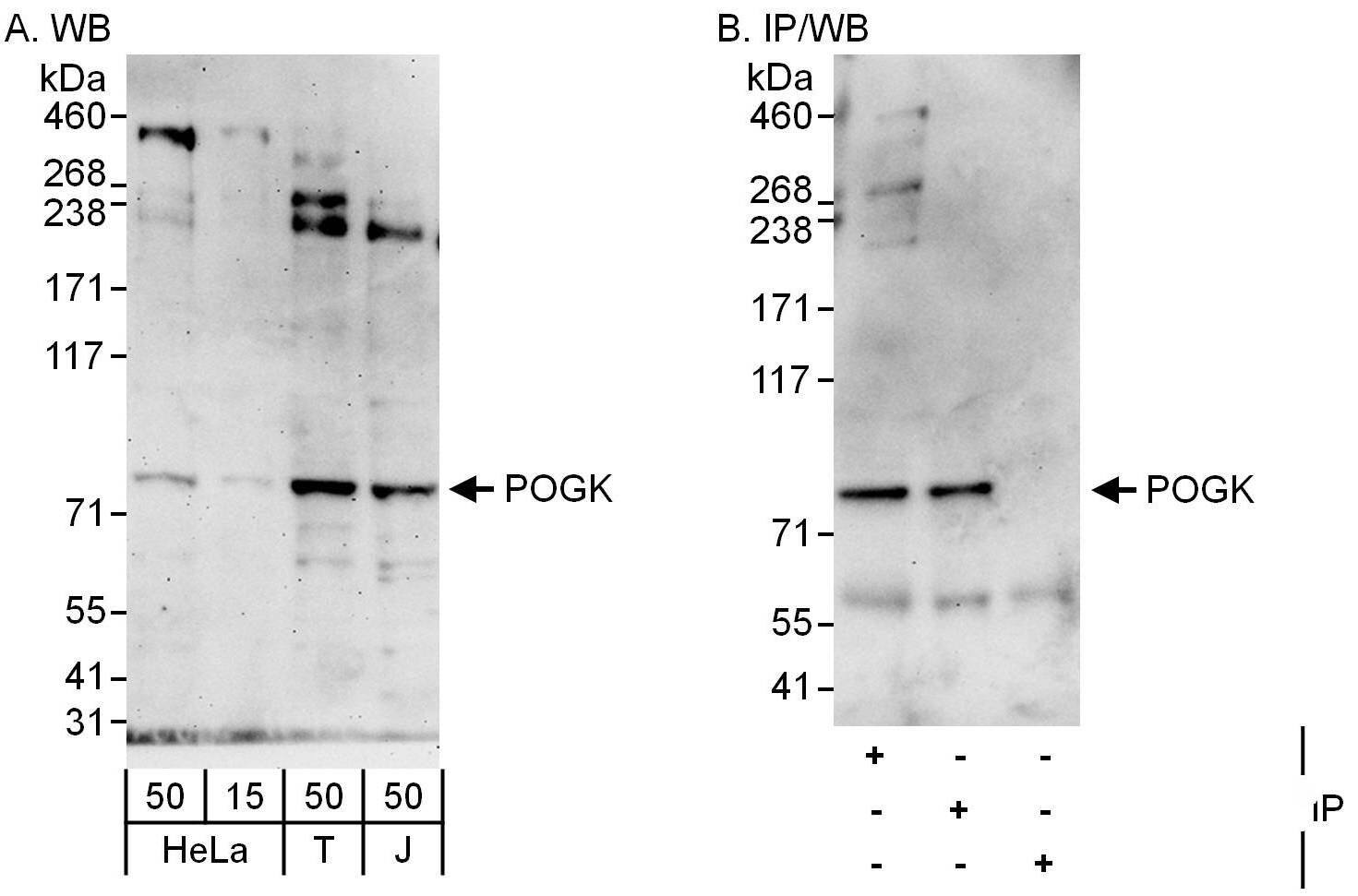 POGK Antibody