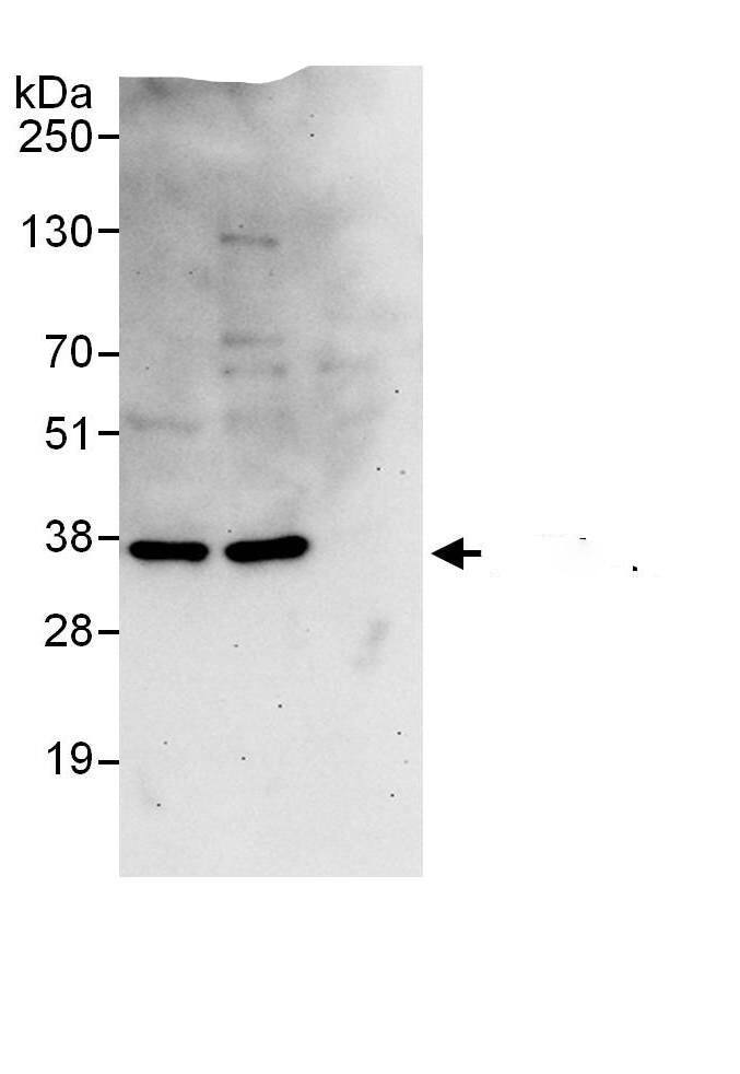 PSMD14 Antibody