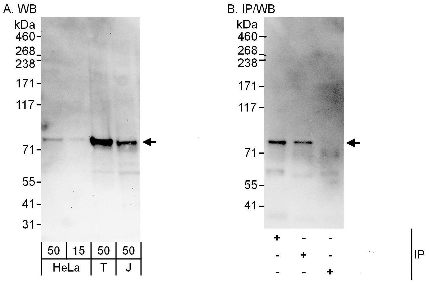 CENPI Antibody