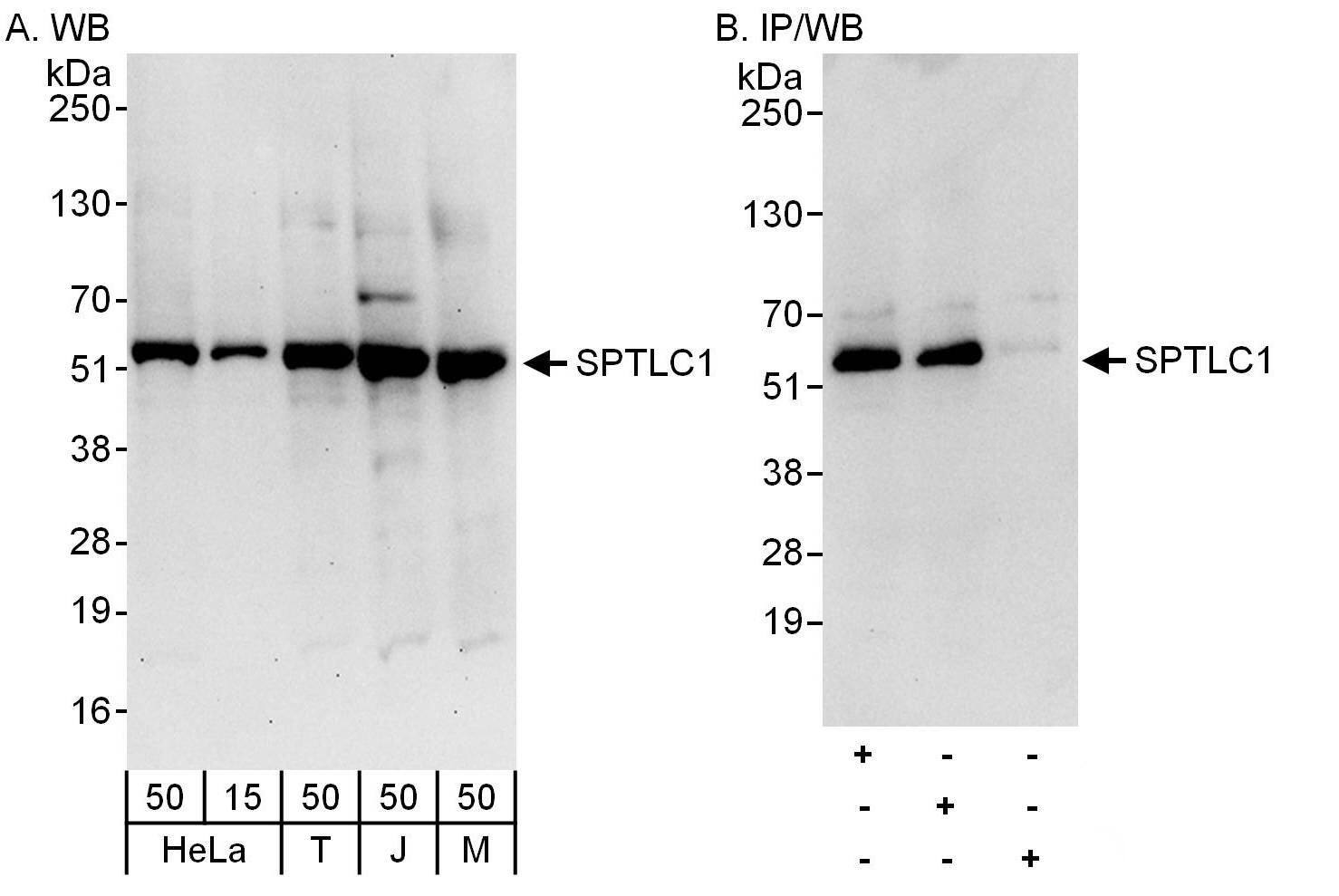 SPTLC1 Antibody