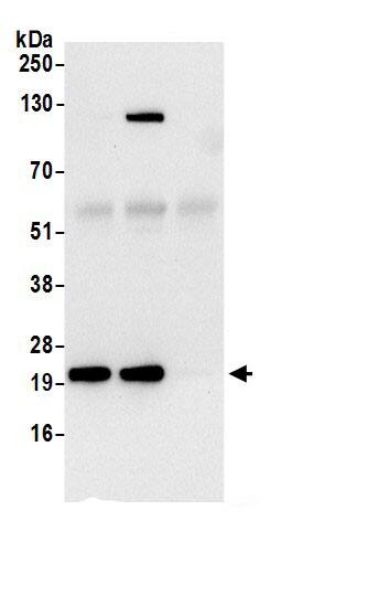 RPL18A Antibody