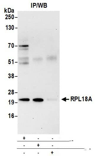 RPL18A Antibody