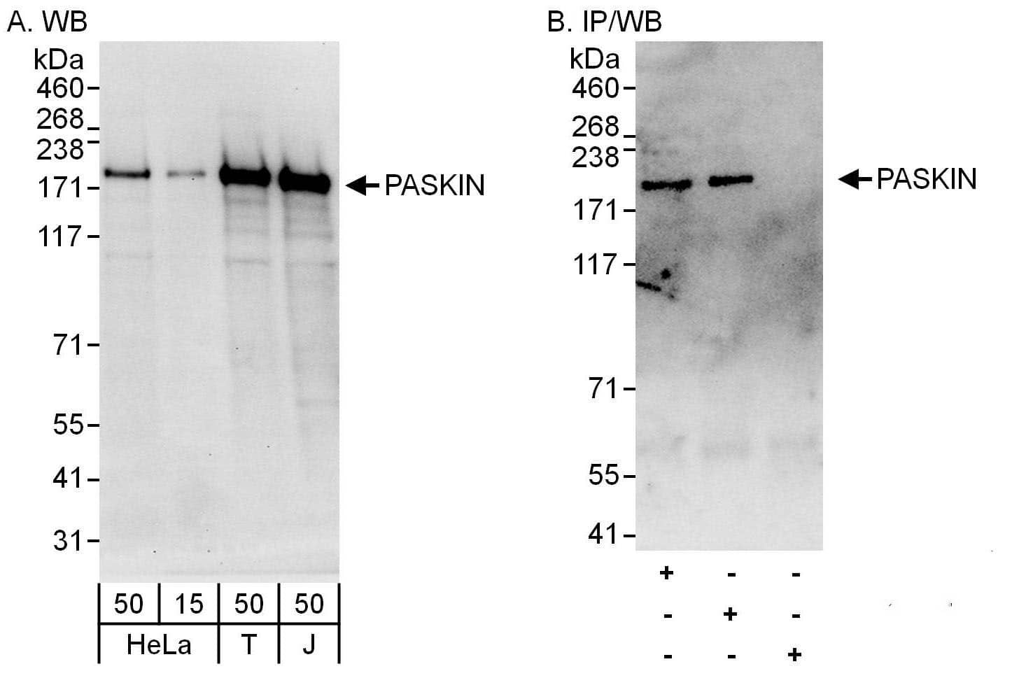 PASK Antibody