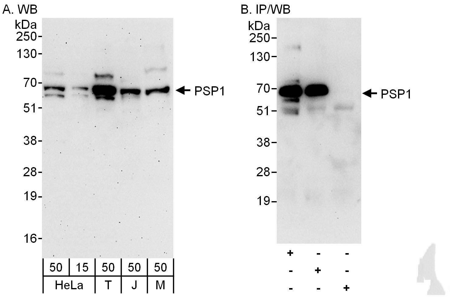 PSPC1 Antibody