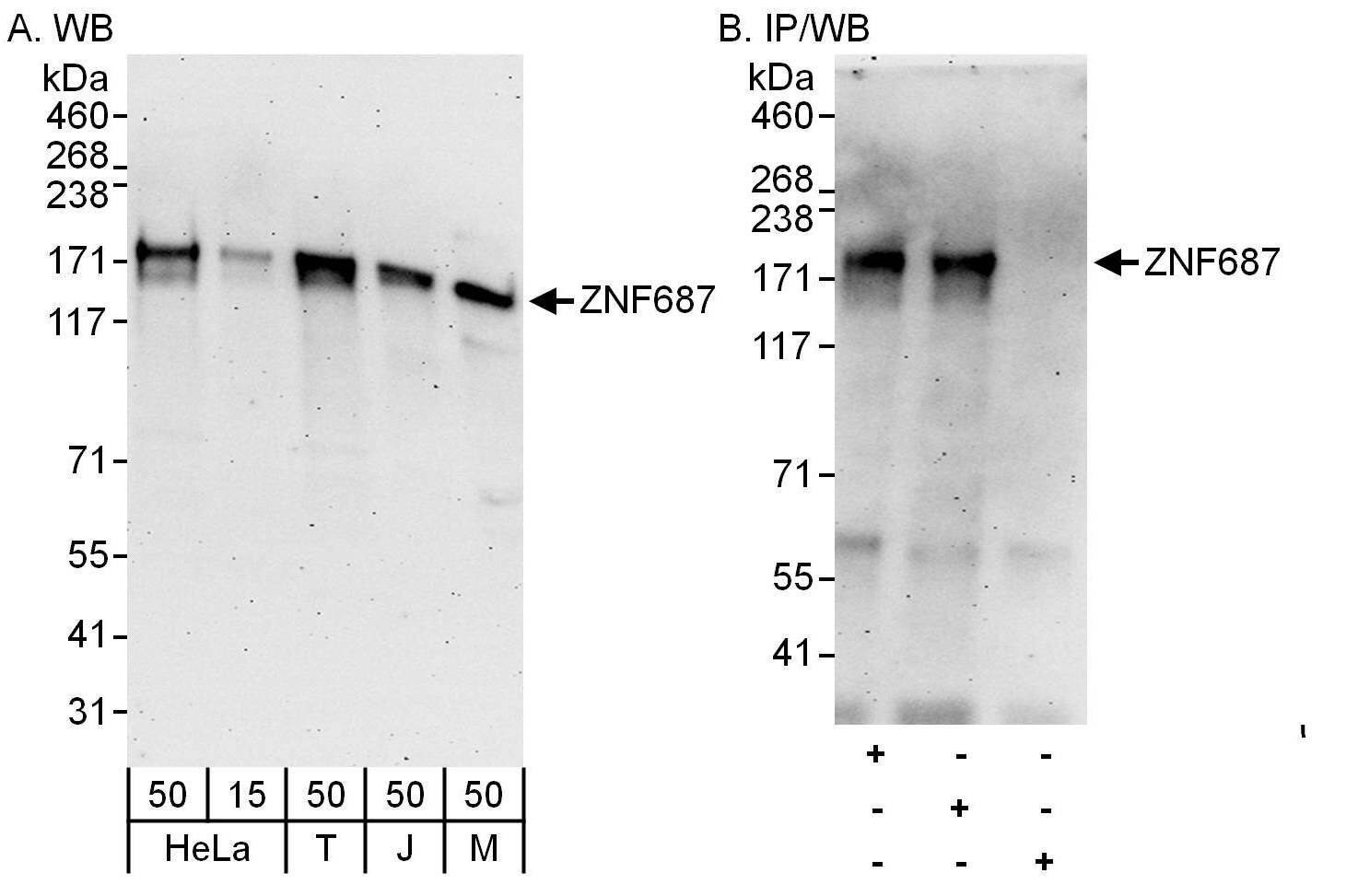 ZNF687 Antibody