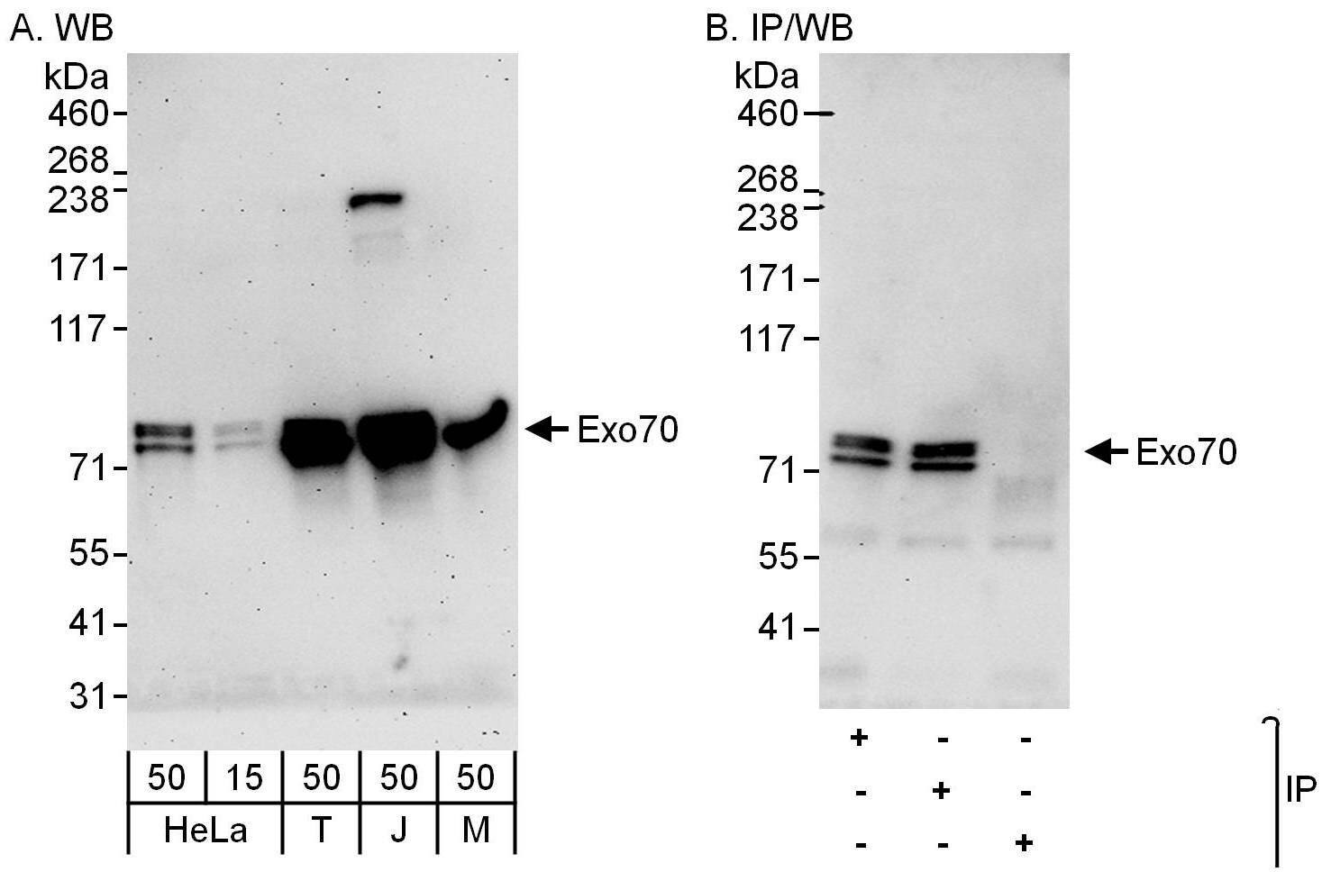 EXOC7 Antibody