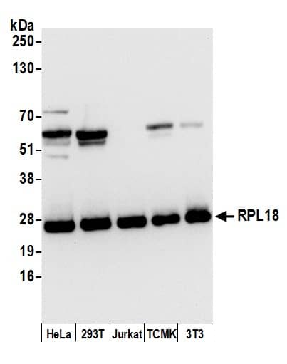 RPL18 Antibody