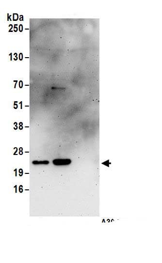 RPS5 Antibody