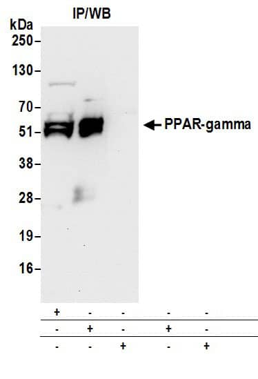 PPAR gamma/NR1C3 Antibody