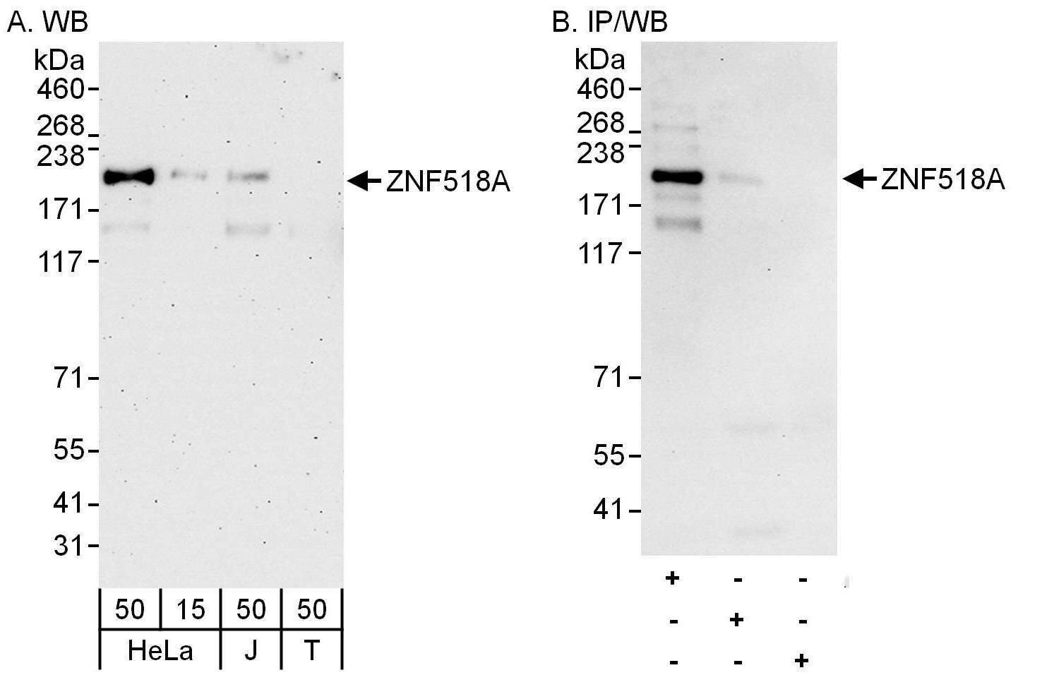 ZNF518 Antibody