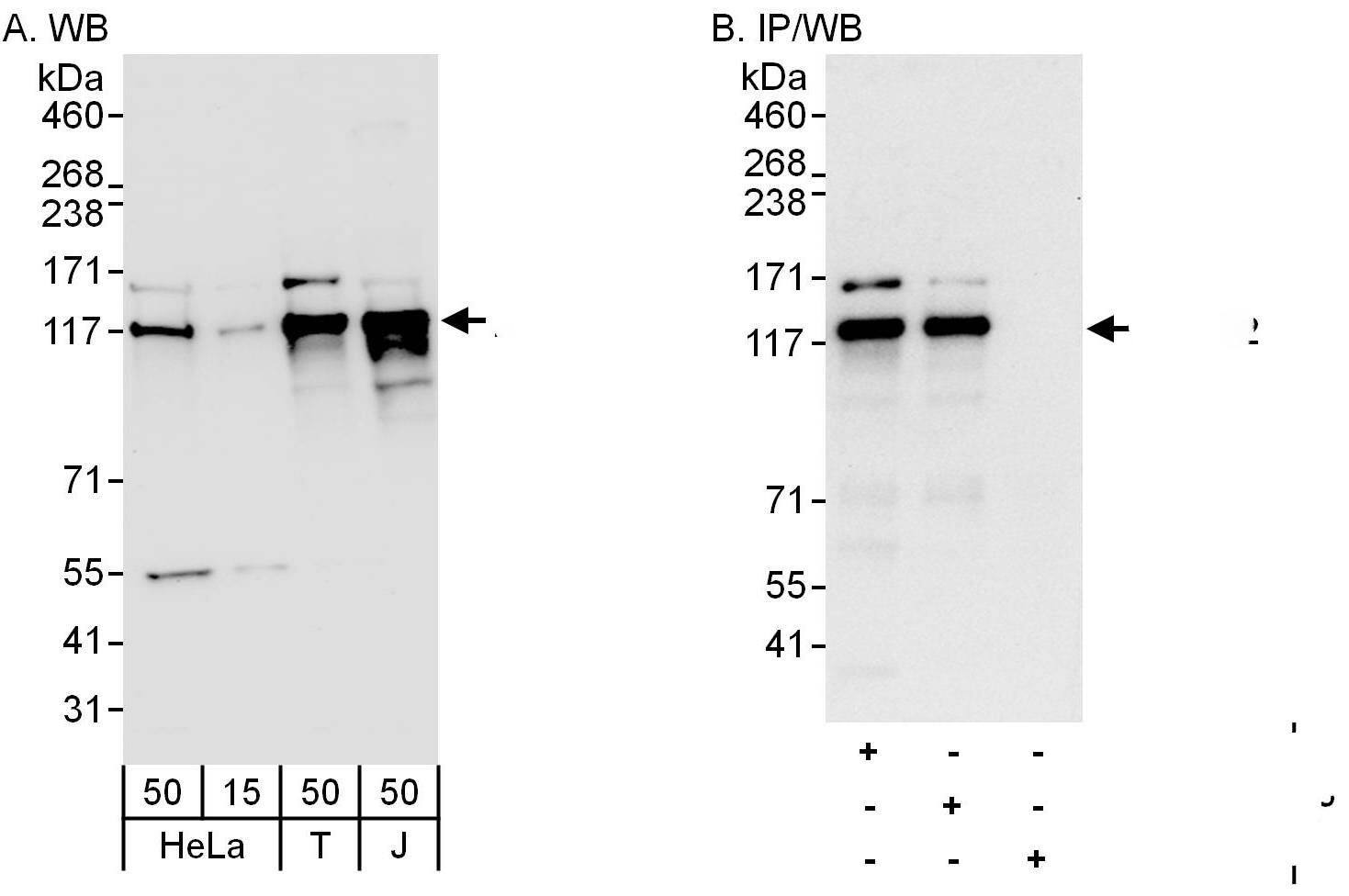 DDX42 Antibody